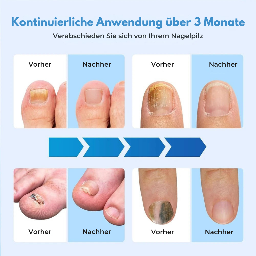 NeoClear® LLLT-Gerät