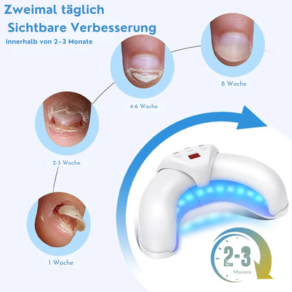 NeoClear® LLLT-Gerät