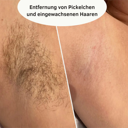 Shave & Glow | Damenrasierer | 2-in-1